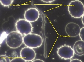 Resultado de imagen de imagenes pleomorfos sangre campo oscuro